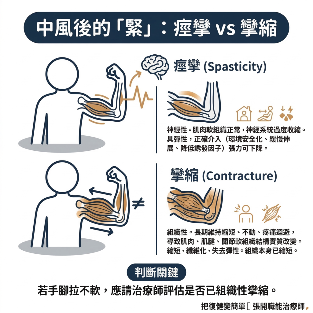 【中風復健】中風後痙攣完整指南〡什麼是痙攣?為什麼會發生?在家怎麼做? 8 Stroke Rehab Spasticity Vs Weakness Vs Contracture:10