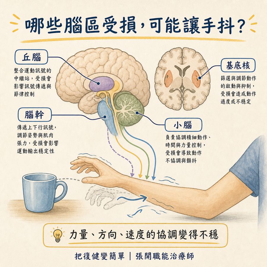 【中風復健】中風後手抖怎麼辦?〡中風後震顫的原因、治療與 5 個居家訓練方法 6 丘腦、小腦、腦幹與基底核受損可能影響手部動作協調
