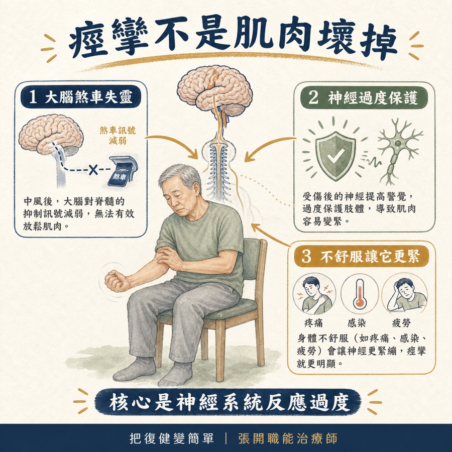 【中風復健】中風後痙攣完整指南〡什麼是痙攣?為什麼會發生?在家怎麼做? 7 中風後痙攣的三層神經機制