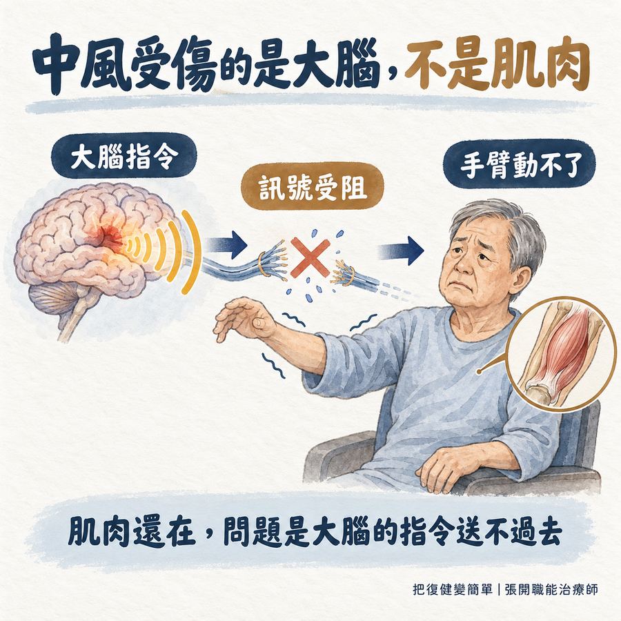 【中風復健】中風後手臂不會動怎麼辦?〡先從這 5 種方法開始 3 中風受傷的是大腦而不是肌肉,大腦指令受阻後手臂無法動作
