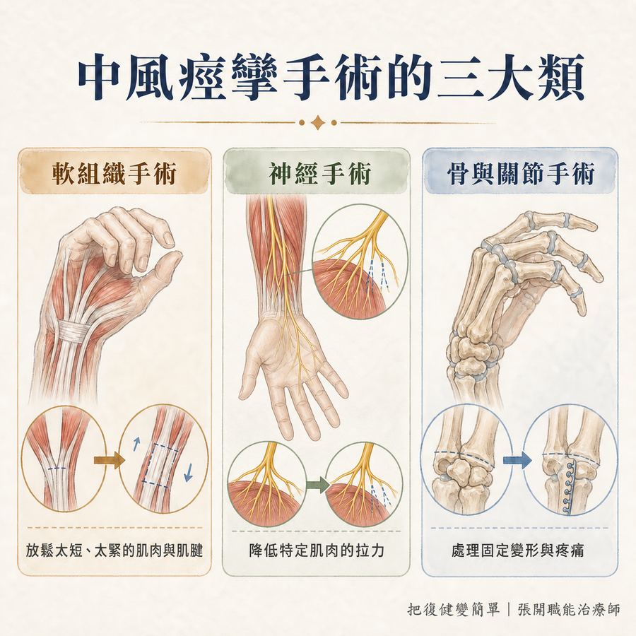 【中風復健】中風後手握拳打不開怎麼辦?〡痙攣手術的適用情況、治療目標與術後復健 5 中風痙攣手術可分為軟組織、神經、骨與關節三大類