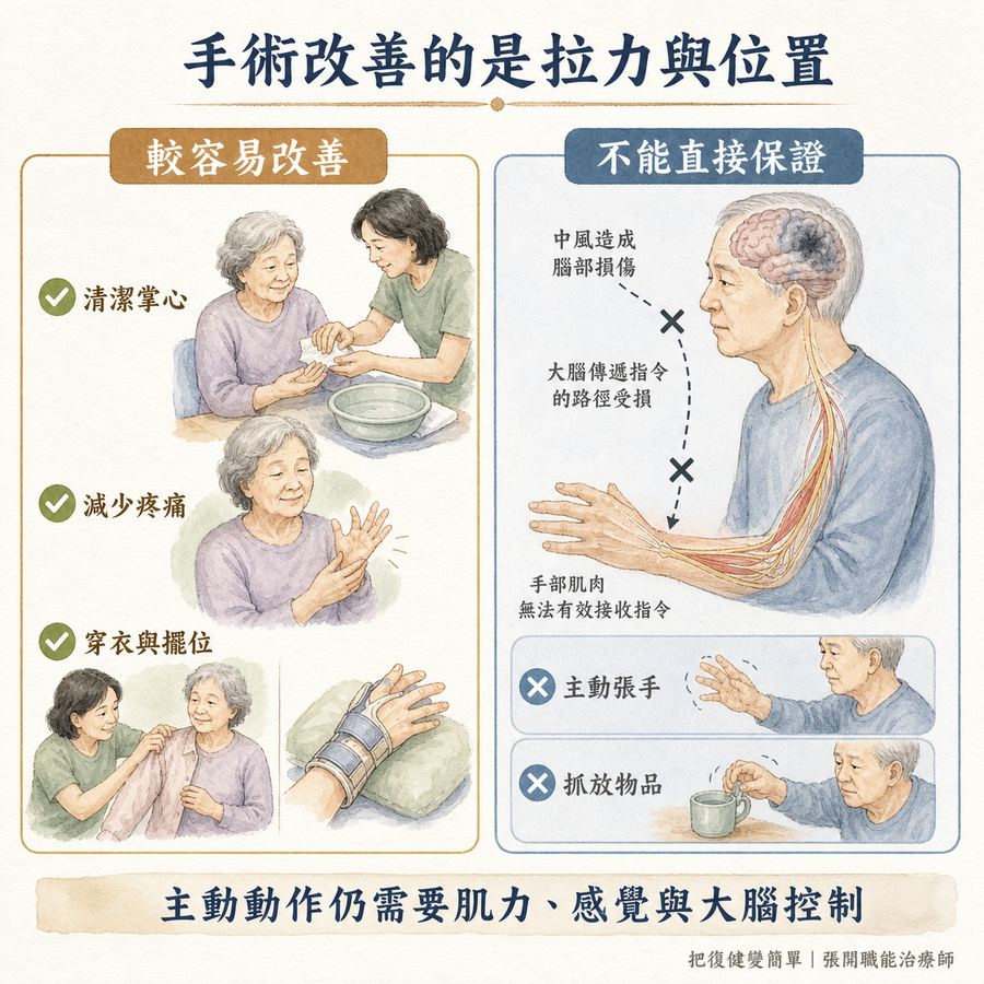 【中風復健】中風後手握拳打不開怎麼辦?〡痙攣手術的適用情況、治療目標與術後復健 6 痙攣手術可改善肢體拉力與位置,但不能保證恢復主動張手與抓放