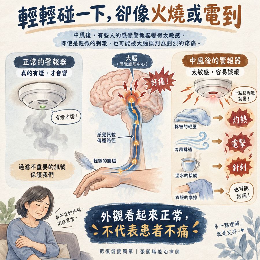 【中風症狀】中風後疼痛怎麼辦?〡中風後的 3 種疼痛與處理方式 6 中風後疼痛訊號異常如同過度敏感的煙霧警報器